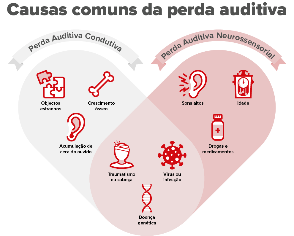 Causas da perda auditiva condutiva e neurossensorial, incluindo objetos estranhos, cera acumulada, traumatismo, sons altos, idade, vírus e fatores genéticos.