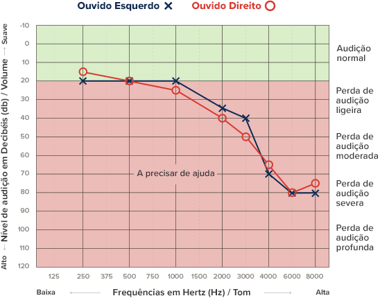 Resultados de um audiograma