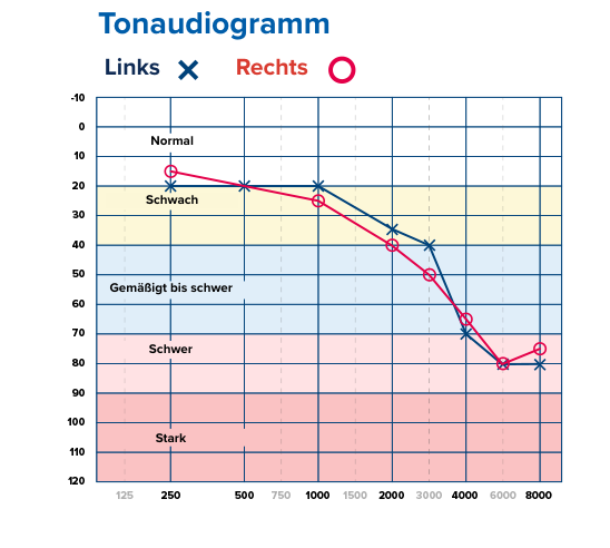 Illustration zeigt Audiogramm
