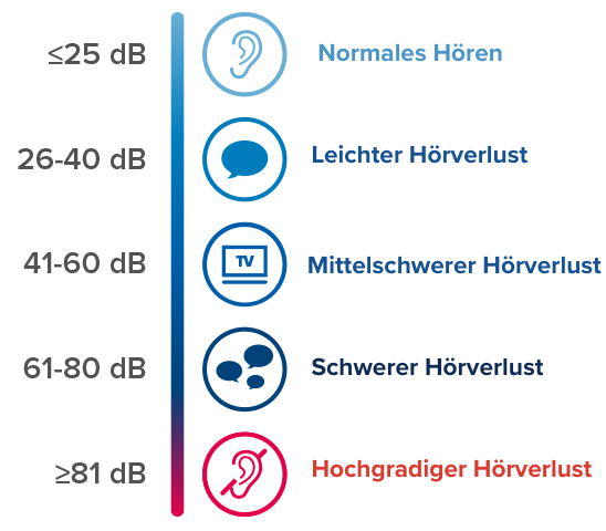 Eine Grafik, die die 5 Grade an Hörverlust darstellt, von normalem Hören bis zum hochgradigen Hörverlust