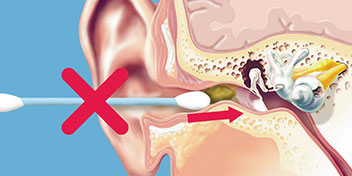 Illustration af et øre, hvor en vatpind skubber ørevoks indad, markeret med et rødt kryds. Budskabet advarer mod at bruge vatpinde til ørepleje.