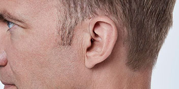 Una oreja masculina en primer plano destaca, con cabello corto y castaño como contexto, posiblemente en un entorno clínico relacionado con audición. No hay audífonos ni texto visible.