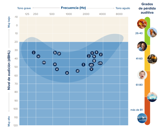 Un audiograma muestra la 