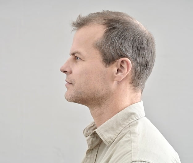 Appareils auditifs Blink B400 portés de profil