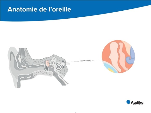 Schéma de l’anatomie de l’oreille montrant les osselets et leurs différentes parties.