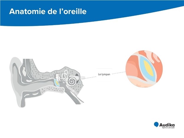 Schéma anatomique de l’oreille mettant en évidence le tympan et ses différentes parties.