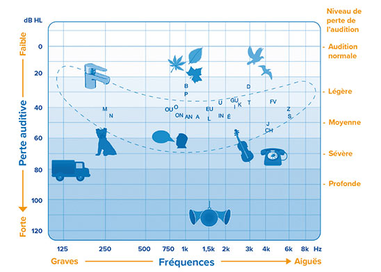 Audiogramme illustrant les fréquences sonores, les niveaux de bruit et les degrés de perte auditive