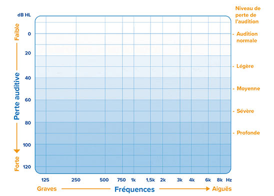 Graphique représentant une audiogramme, montrant les fréquences (Hz) de 125 à 8k sur l'axe horizontal et les niveaux de perte auditive (dB HL) de 0 à 120 sur l'axe vertical. À droite, une légende indique les classifications auditives : « Audition normale », « Légère », « Moyenne », « Sévère » et « Profonde ». Contexte : outil utilisé par un audioprothésiste lors d’un test auditif en clinique Audika.