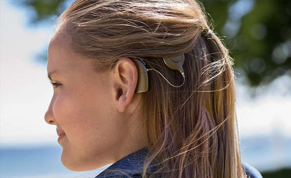 Donna con impianto cocleare all'aperto
