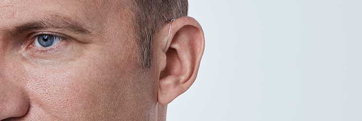 Audika Academy - Traumi vestibolari