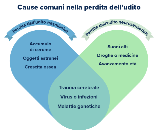 Infografica con due cerchi sovrapposti che distinguono le cause della perdita dell’udito: trasmissiva (cerume, oggetti estranei, crescita ossea) e neurosensoriale (suoni alti, farmaci, età); al centro, cause comuni: trauma cerebrale, virus/infezioni, malattie genetiche. Testo in alto: 'Cause comuni nella perdita dell’udito.'