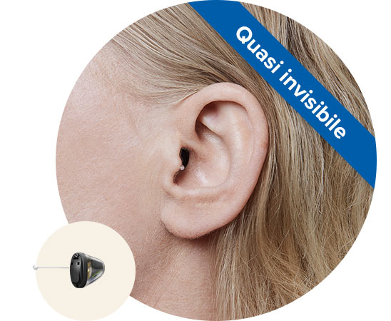 Un orecchio con un apparecchio acustico intrauricolare Audika quasi invisibile.