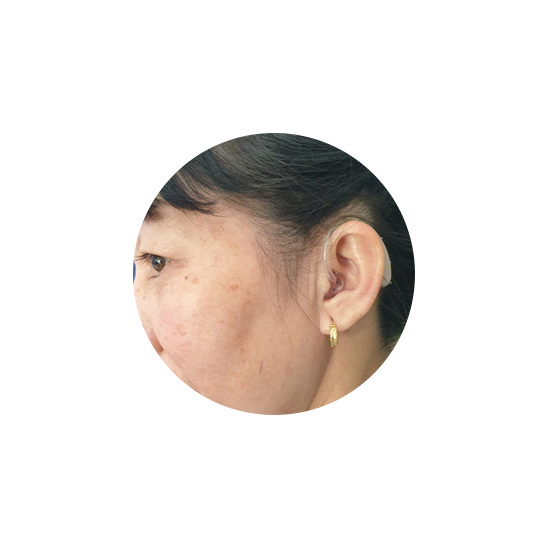 Vrouw met een hoortoestel achter het oor in Vietnam.