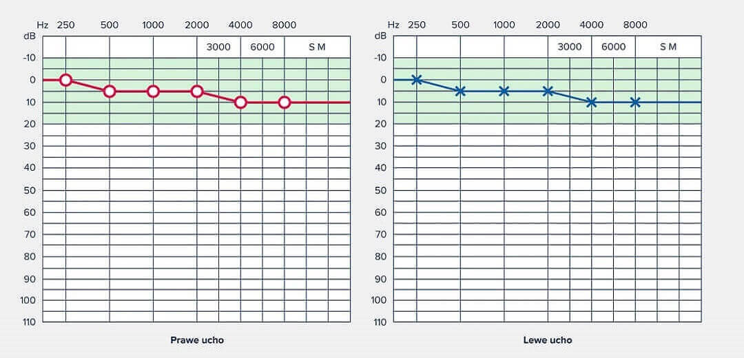 Audiometria tonalna – wyniki dla normy słuchowej (audiogram).