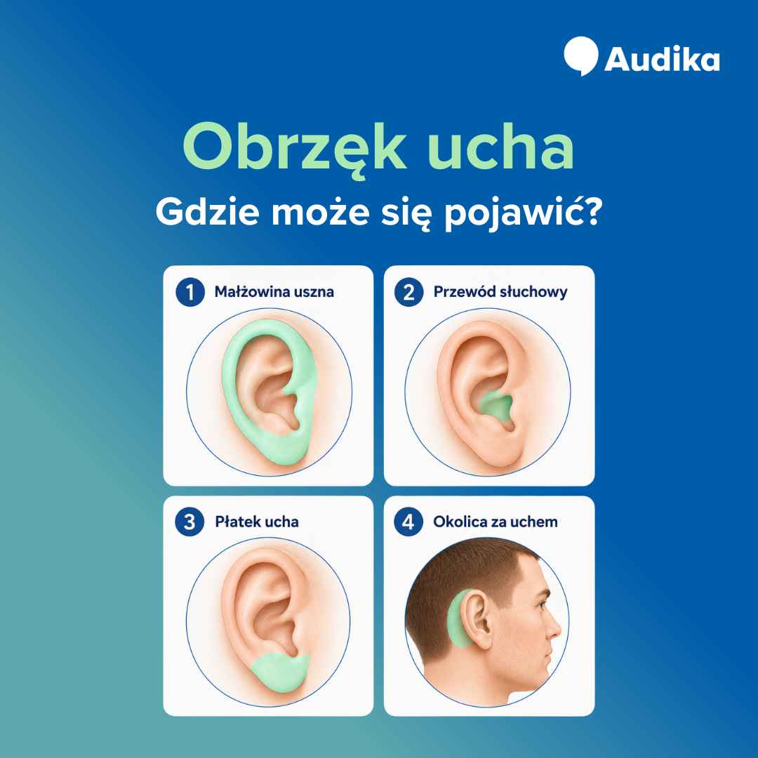 Przyczyny występowania spuchniętego ucha.