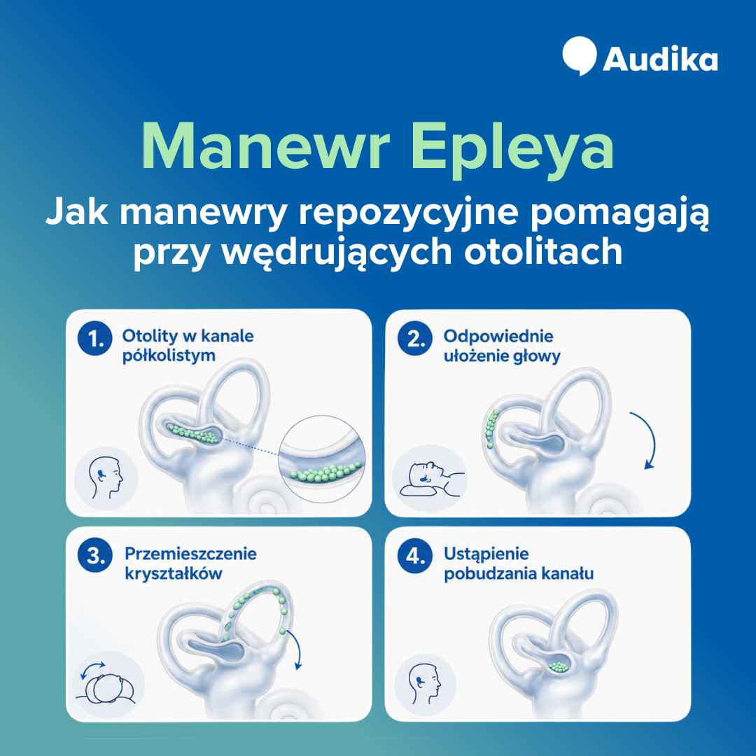 Infografika – manewr Epleya