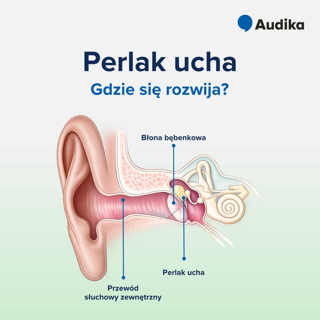 Perlak ucha - gdzie się rozwija? 