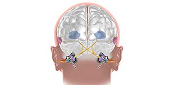  Hjärnan och hörseln – kopplingen mellan hörsel och hjärnans funktion samt hur hörapparater från Audika kan ge stöd.