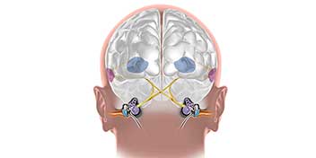 Hjärnan & hörseln - så fungerar sambandet och hörapparater som stödjer hjärnan hos Audika.