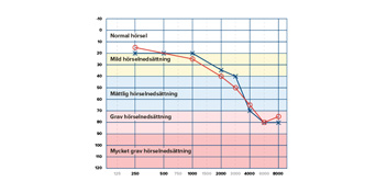 Bild på ett audiogram som visar ett resultat av ett hörseltest