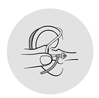  Illustration av en insättning av hörapparat bakom örat