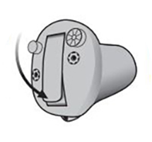  Illustration på hur man sätter in en allt i örat-hörapparat