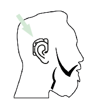  Illustration av telefonering med hörapparat