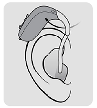  Illustration av hur man sätter bakom-örat-hörapparat korrekt bakom örat.