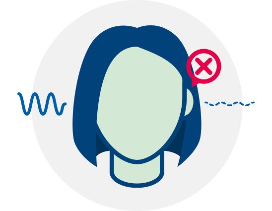  Illustration av unilateral hörselnedsättning med ett kryss över ena örat och ljudvågor på vardera sidan.