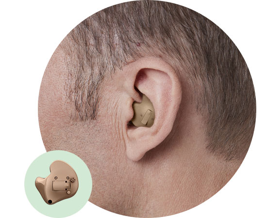 A discreet, in-the-ear hearing aid fits snugly in an individual's ear, with a close-up inset showing detailed features. The device is designed for personalized hearing care, ideal for audiology clinics.