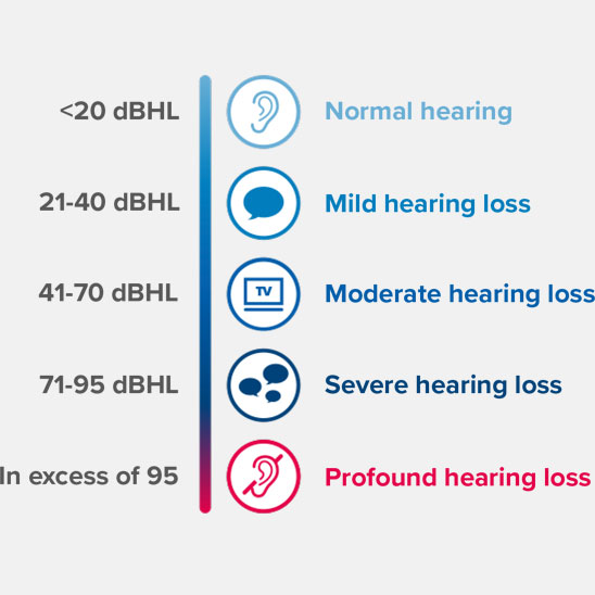 Levels of hearing loss categorized by decibel hearing level (dBHL) ranges: <20 dBHL as normal hearing, 21-40 dBHL as mild hearing loss, 41-70 dBHL as moderate hearing loss, 71-95 dBHL as severe hearing loss, and in excess of 95 dBHL as profound hearing loss.