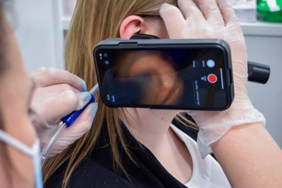 Earwax removal using microsuction performed by a hearing care professional with a camera monitor for visualization.