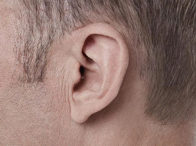 A close-up of a person’s ear visible on the right side, with short brown hair framing the ear; no visible hearing aid or associated text is present in the image.