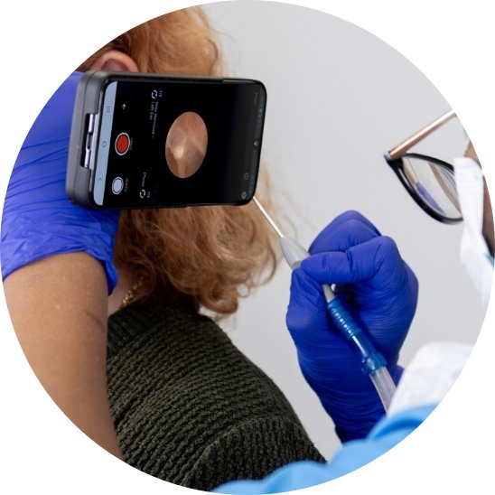Ear wax removal using microsuction technique with a healthcare professional wearing gloves and using a smartphone for visualization.