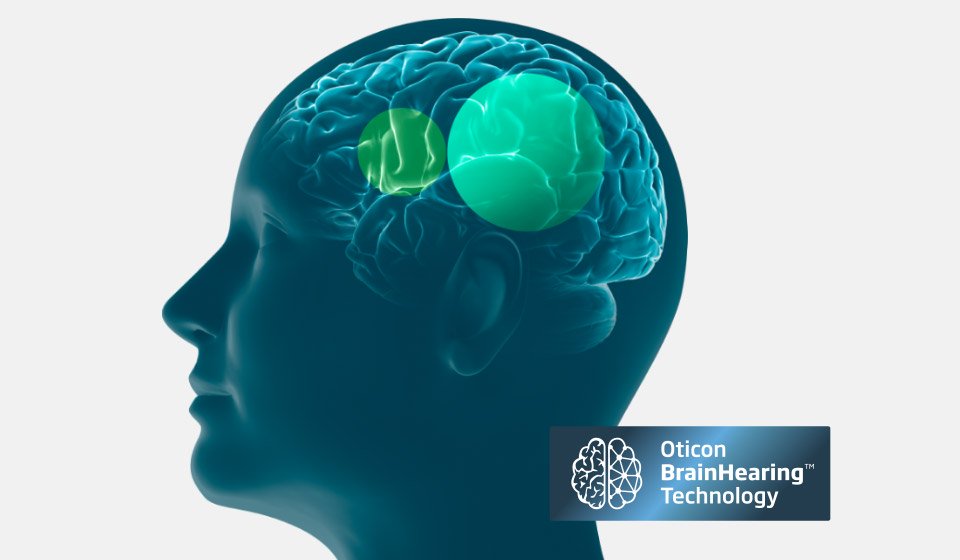 Head illustration highlighting brain activity with Oticon BrainHearing Technology logo.