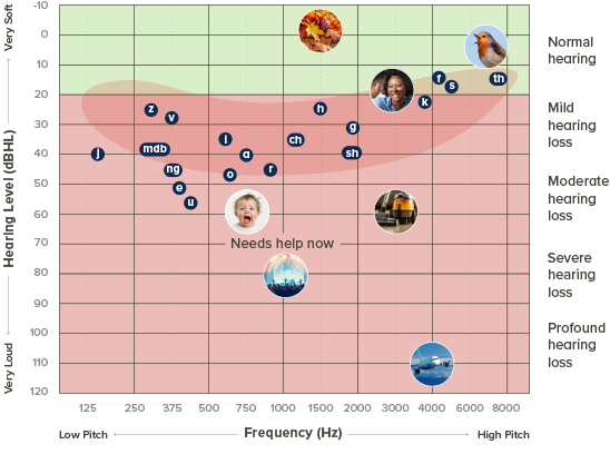 Jak czytać audiogram?