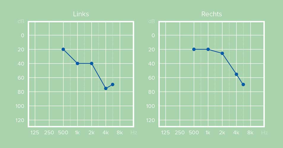 Audiogram