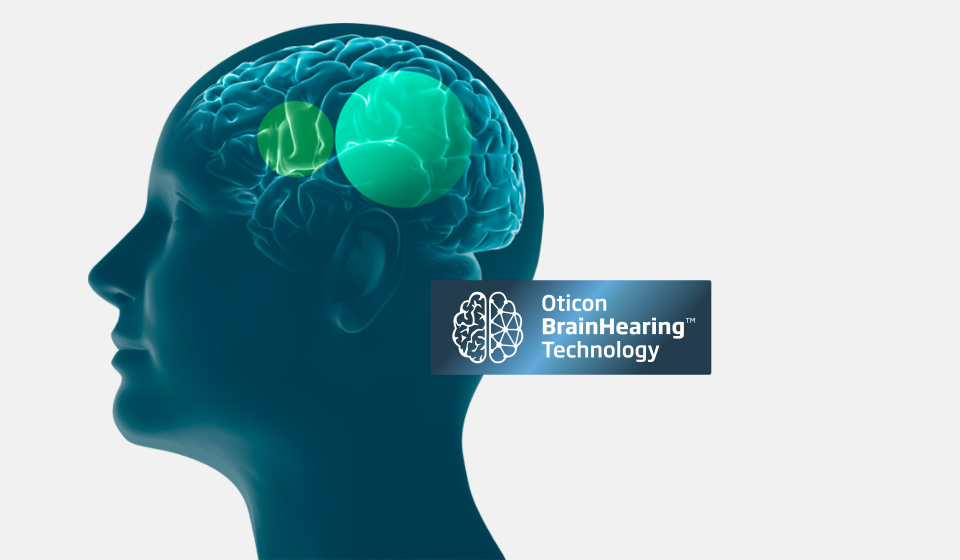 Ein seitliches Profil eines menschlichen Kopfes zeigt ein transparentes Gehirn mit grün hervorgehobenen Bereichen; rechts erscheint der Text 'Oticon BrainHearing Technology' mit einem Symbol eines Gehirns.