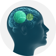 Technologie BrainHearing mettant en évidence les zones actives du cerveau liées à l’audition.