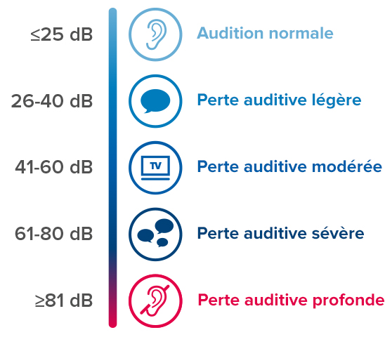 Niveaus de perte auditive