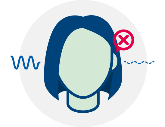 Perte auditive unilatérale représentée par une croix rouge à côté d’une oreille et des ondes sonores interrompues.