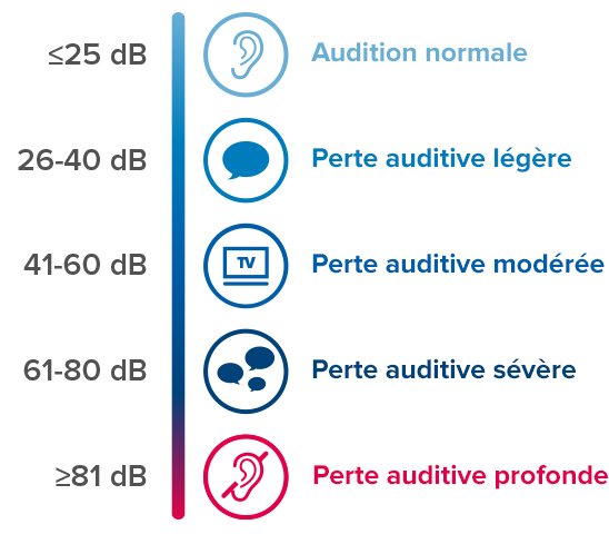 Niveaux de perte auditive allant d’une audition normale à une perte auditive profonde, classés par plages de décibels avec des icônes et des labels explicatifs.