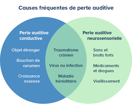 Diagramme de Venn expliquant les « Causes fréquentes de perte auditive » : perte conductive (objet étranger, bouchon de cérumen, croissance osseuse) et neurosensorielle (sons forts, médicaments, vieillissement). Facteurs communs : traumatisme crânien, virus, maladie héréditaire.