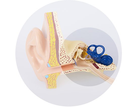 Représentation d’une perte auditive causée par le bruit dans une oreille.